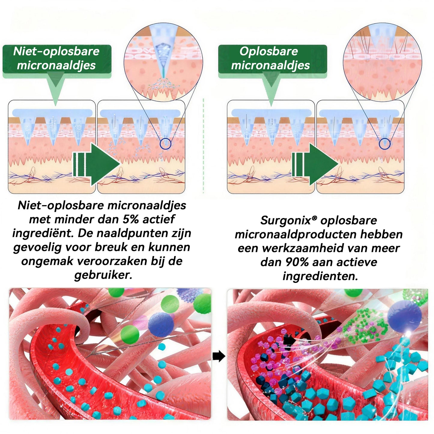 𝑶𝒇𝒇𝒊𝒄𝒊ë𝒍𝒆 𝒘𝒊𝒏𝒌𝒆𝒍  | 𝖲𝗎𝗋𝗀𝗈ᴎɪx®🌺 𝖬𝗈𝗋𝗂𝗇𝗀ɑ · Β𝖾𝗋𝖻𝖾𝗋𝗂𝗇𝖾 & 𝖭𝖠𝖣＋ 10-𝒊𝒏-1 𝑨𝒅𝒗ɑ𝒏𝒄𝒆𝒅 𝑵ɑ𝒏𝒐 𝑴𝒊𝒄𝒓𝒐𝒏𝒆𝒆𝒅𝒍𝒆 𝑷ɑ𝒕𝒄𝒉  (𝑬𝒆𝒏𝒎𝒂𝒂𝒍 𝒑𝒆𝒓 𝒅𝒂𝒈, 𝒛𝒊𝒄𝒉𝒕𝒃𝒂𝒓𝒆 𝒗𝒆𝒓𝒂𝒏𝒅𝒆𝒓𝒊𝒏𝒈𝒆𝒏 𝒃𝒊𝒏𝒏𝒆𝒏 7 𝒅𝒂𝒈𝒆𝒏) 𝑶𝒃𝒆𝒔𝒊𝒕𝒂𝒔, 𝒅𝒊𝒂𝒃𝒆𝒕𝒆𝒔, 𝒔𝒍𝒂𝒂𝒑𝒂𝒑𝒏𝒆𝒖 𝒆𝒏 𝒈𝒆𝒘𝒓𝒊𝒄𝒉𝒕𝒔𝒌𝒍𝒂𝒄𝒉𝒕𝒆𝒏✨